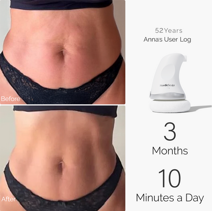 Tightening & Toning Bundle Pro™