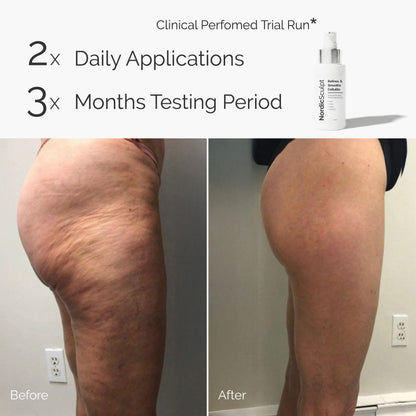 Cellulite Smoothening BodyOil™