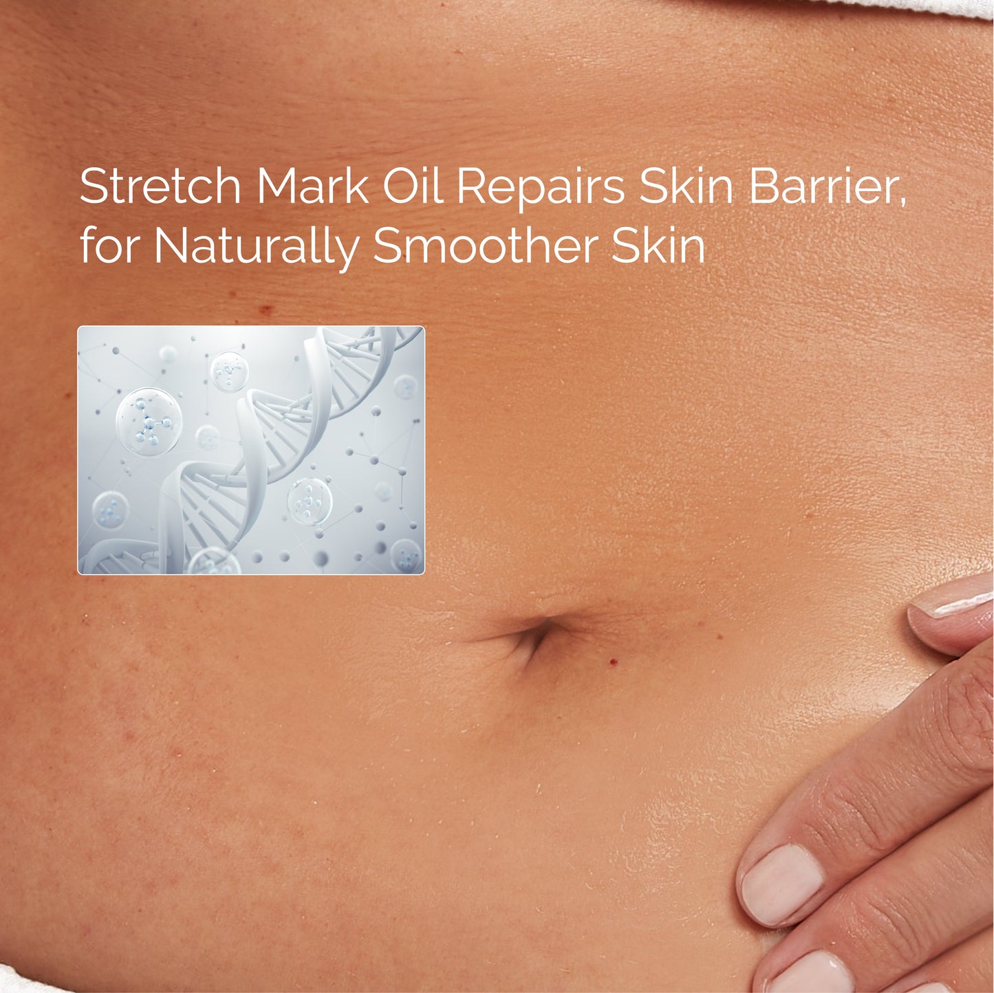 Stretch Marks Smoothening BodyOil™