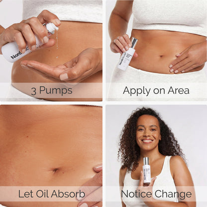 Stretch Marks Smoothening BodyOil™